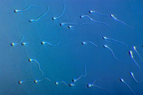 精子的照片,探索生命起源的奥秘